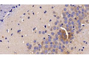 Detection of TNFR1 in Mouse Cerebrum Tissue using Polyclonal Antibody to Tumor Necrosis Factor Receptor 1 (TNFR1) (TNFRSF1A antibody  (AA 239-433))