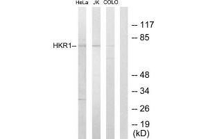 Western blot analysis of extracts from HeLa cells, Jurkat cells and COLO205 cells, using HKR1 antibody. (HKR1 antibody  (Internal Region))