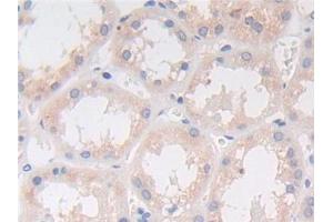 Detection of C9 in Human Kidney Tissue using Polyclonal Antibody to Complement Component 9 (C9) (C9 antibody  (AA 22-265))