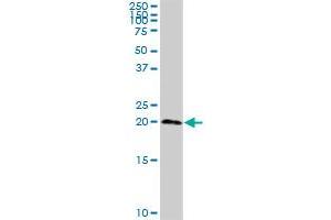 TSEN15 antibody  (AA 1-171)