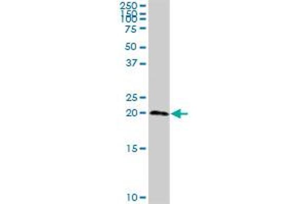 TSEN15 antibody  (AA 1-171)