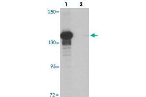 Western blot analysis of KDM6B in K-562 cell lysate with KDM6B polyclonal antibody  at 0.