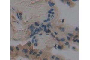 #VALUE! (FADS3 antibody  (AA 331-445))