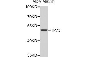 Western blot analysis of extracts of MDA-MB231 cells, using TP73 antibody (ABIN3046814). (Tumor Protein p73 antibody)