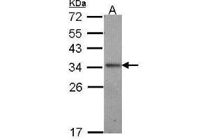 WB Image Sample (30 ug of whole cell lysate) A: A431 , 12% SDS PAGE antibody diluted at 1:1000 (IL-24 antibody  (C-Term))
