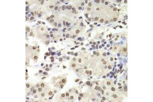 Immunohistochemistry (Paraffin-embedded Sections) (IHC (p)) image for anti-RuvB-Like 1 (E. Coli) (RUVBL1) (AA 1-240) antibody (ABIN6147319)