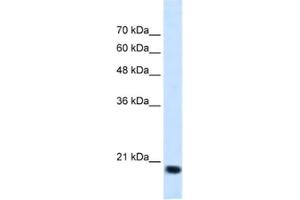 Western Blotting (WB) image for anti-Signal Sequence Receptor, beta (Translocon-Associated Protein Beta) (SSR2) antibody (ABIN2462852) (SSR2 antibody)