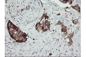 Image no. 2 for anti-Tumor Protein D52-Like 3 (TPD52L3) antibody (ABIN1501476)