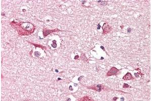 Anti-PLCG1 antibody IHC staining of human brain, cortex. (Phospholipase C gamma 1 antibody)