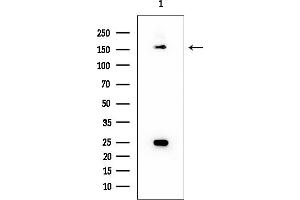 Western blot analysis of lysates from COLO205 cells, using TAO2 Mouse Monoclonal Antibody at 1/1000 dilution.
