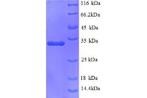 SDS-PAGE (SDS) image for Mucin 5AC, Oligomeric Mucus/gel-Forming (MUC5AC) (AA 2452-2721), (partial) protein (His tag) (ABIN5713076) (MUC5AC Protein (AA 2452-2721, partial) (His tag))