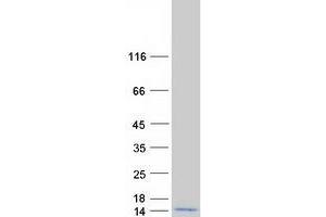 Validation with Western Blot