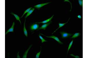 Immunofluorescence staining of Hela cells with ABIN7153745 at 1:133, counter-stained with DAPI. (GMDS antibody  (AA 243-346))