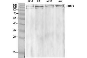 Western Blot (WB) analysis of specific cells using HDAC7 Polyclonal Antibody.