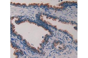 IHC-P analysis of prostate gland tissue, with DAB staining. (PLAA antibody  (AA 534-792))