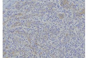 ABIN6276937 at 1/100 staining Human gastric tissue by IHC-P. (SLC25A4 antibody  (Internal Region))