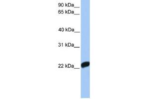 WB Suggested Anti-F10 Antibody Titration:  0. (Coagulation Factor X antibody  (C-Term))