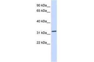 Image no. 1 for anti-Tropomyosin alpha-1 Chain (TM7) (C-Term) antibody (ABIN6743064) (TM7 antibody  (C-Term))