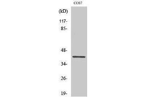 Western Blotting (WB) image for anti-GATA Binding Protein 1 (Globin Transcription Factor 1) (GATA1) (pSer310) antibody (ABIN3182019) (GATA1 antibody  (pSer310))