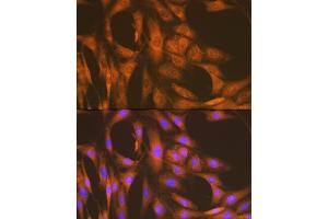 Immunofluorescence analysis of C6 cells using U Rabbit mAb (ABIN7271211) at dilution of 1:100 (40x lens). (UAP1 antibody)