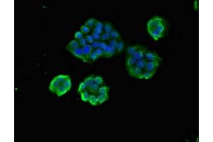 Immunofluorescent analysis of PC-3 cells using ABIN7144564 at dilution of 1:100 and Alexa Fluor 488-congugated AffiniPure Goat Anti-Rabbit IgG(H+L) (ARAP1 antibody  (AA 69-344))