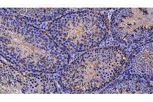 Detection of PRDX2 in Mouse Testis Tissue using Polyclonal Antibody to Peroxiredoxin 2 (PRDX2) (Peroxiredoxin 2 antibody  (AA 6-164))
