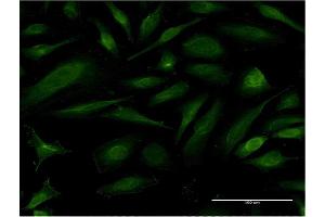 Immunofluorescence of monoclonal antibody to EIF1AY on HeLa cell. (EIF1AY antibody  (AA 31-120))