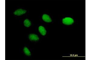 Immunofluorescence of purified MaxPab antibody to CENPK on HeLa cell. (CENPK antibody  (AA 1-269))