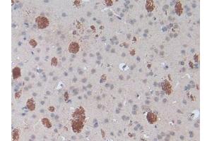 Detection of SPRY1 in Mouse Brain Tissue using Polyclonal Antibody to Sprouty Homolog 1 (SPRY1) (SPRY1 antibody  (AA 112-303))