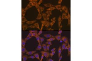 Immunofluorescence analysis of NIH-3T3 cells using CAD Rabbit mAb (ABIN7266064) at dilution of 1:100 (40x lens). (CAD antibody)