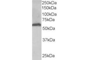 Western Blotting (WB) image for anti-Formiminotransferase Cyclodeaminase (FTCD) (N-Term) antibody (ABIN2465215) (FTCD antibody  (N-Term))