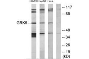 Western blot analysis of extracts from HeLa/HepG2/HuvEc cells, using GRK5 Antibody. (GRK5 antibody  (AA 351-400))