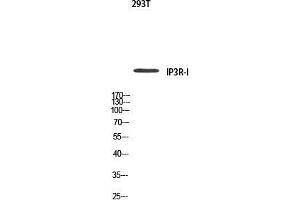 Western Blot (WB) analysis of 293T using IP3R-I antibody. (ITPR1 antibody)