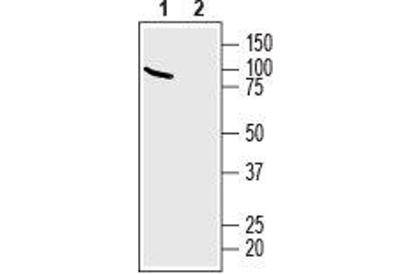 SLC9A6 抗体  (C-Term, Intracellular)