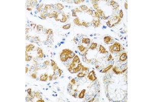 Immunohistochemistry of paraffin-embedded human stomach using CCL2 antibody at dilution of 1:100 (40x lens). (CCL2 antibody)