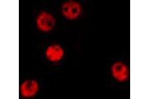 ABIN6274374 staining HepG2 by IF/ICC. (TSC22D1 antibody  (C-Term))