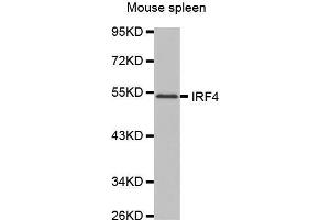 Western Blotting (WB) image for anti-Interferon Regulatory Factor 4 (IRF4) (AA 150-350) antibody (ABIN6213873) (IRF4 antibody  (AA 150-350))