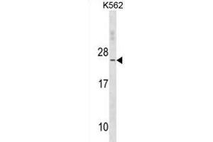 TNNC2 Antibody (C-term) (ABIN1881894 and ABIN2838656) western blot analysis in K562 cell line lysates (35 μg/lane).