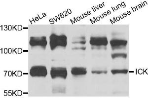Western blot analysis of extracts of various cell lines, using ICK antibody (ABIN5974764) at 1/1000 dilution. (ICK antibody)