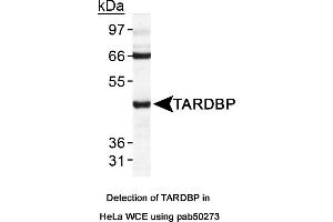 Image no. 1 for anti-TAR DNA Binding Protein (TARDBP) (AA 350-414), (C-Term) antibody (ABIN363582) (TARDBP antibody  (C-Term))