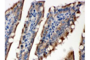 Immunohistochemistry (Paraffin-embedded Sections) (IHC (p)) image for anti-Sulfotransferase Family, Cytosolic, 2B, Member 1 (SULT2B1) (AA 190-218), (Middle Region) antibody (ABIN3043414) (SULT2B1 antibody  (Middle Region))