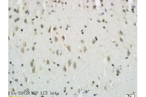 Formalin-fixed and paraffin embedded rat brain tissue labeled with Anti-LC3B/MAP LC3? (MAP1LC3A/B antibody  (AA 21-121))