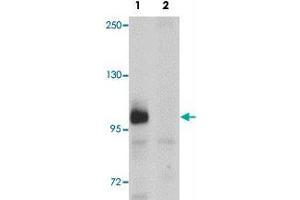 Western blot analysis of ZC3HAV1 in HeLa cell lysate with ZC3HAV1 polyclonal antibody  at 1ug/mL in (1) the absence and (2) the presence of blocking peptide. (ZC3HAV1 antibody  (C-Term))