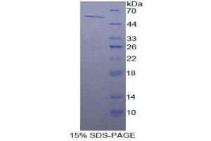 SDS-PAGE (SDS) image for Aldehyde Dehydrogenase 7 Family, Member A1 (ALDH7A1) (AA 28-539) protein (His tag) (ABIN1078763)