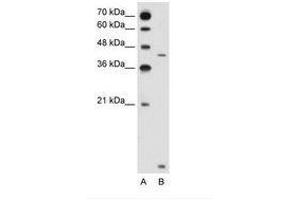 Image no. 2 for anti-Solute Carrier Family 46, Member 3 (SLC46A3) (N-Term) antibody (ABIN205029) (SLC46A3 antibody  (N-Term))