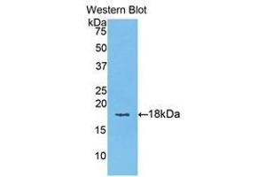 Western Blotting (WB) image for anti-Keratin 6A (KRT6A) (AA 323-461) antibody (ABIN1176074) (KRT6A antibody  (AA 323-461))