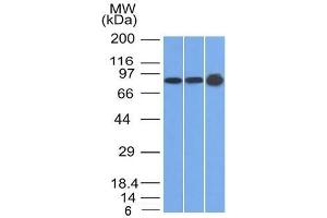 Western Blot of U87, HeLa and A431 cell lysates using Plakophilin-1 Mouse Monoclonal Antibody (10B2) (Plakophilin 1 antibody  (N-Term))