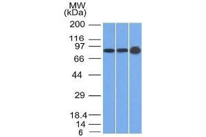 Western Blot of U87, HeLa and A431 cell lysates using Plakophilin-1 Mouse Monoclonal Antibody (10B2)