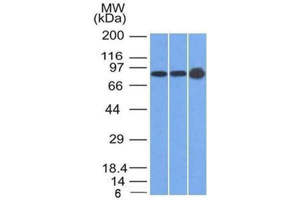 Plakophilin 1 antibody  (N-Term)