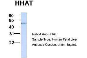 Host:  Rabbit  Target Name:  HHAT  Sample Type:  Human Fetal Liver  Antibody Dilution:  1. (HHAT antibody  (N-Term))